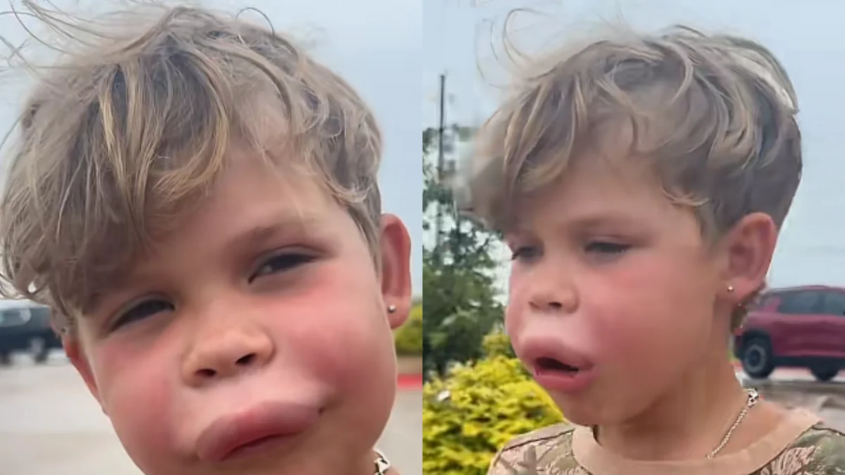 Menino é picado por vespa e reage com tranquilidade ao ver lábio inchado