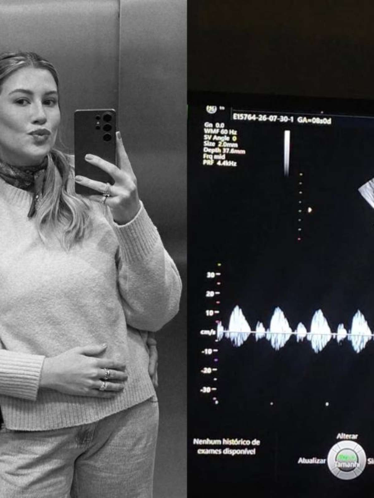 Niina Secrets revela perda de bebê: ‘Dor e uma tristeza no coração’