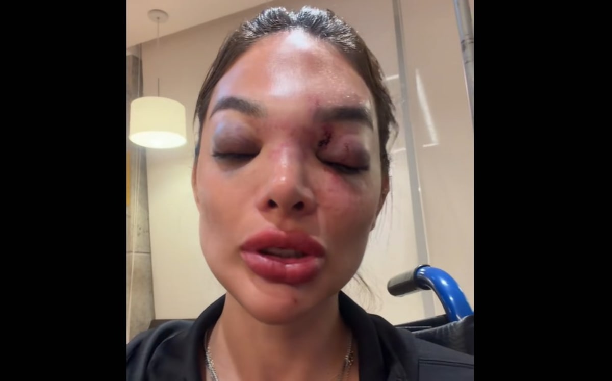 Justiça nega prisão de empresário da Faria Lima acusado de agredir a mulher; MP recorre pela 2ª vez