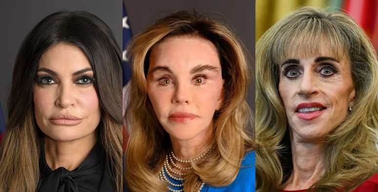 Mulheres poderosas ao redor de Trump são vítimas de ‘body shaming’ nas redes sociais