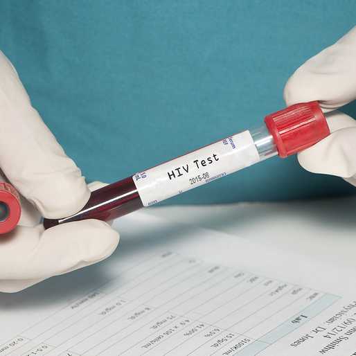 HIV diagnoses drop, but 128,000 Filipinos may be unaware they’re infected