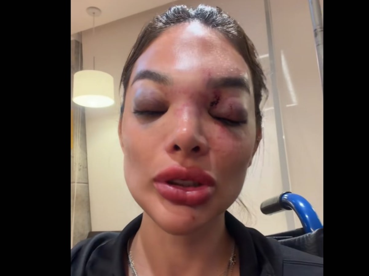 Justiça nega prisão de empresário da Faria Lima acusado de agredir a mulher; MP recorre pela 2ª vez