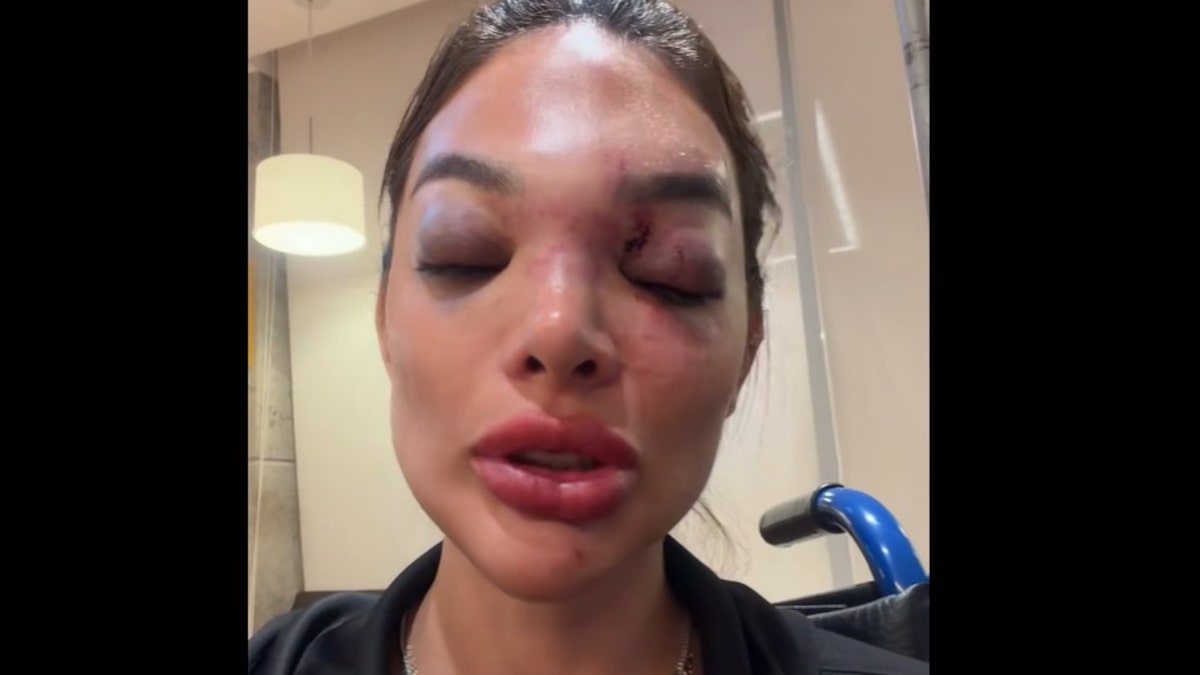 Justiça nega prisão de empresário da Faria Lima acusado de agredir a mulher; MP recorre pela 2ª vez
