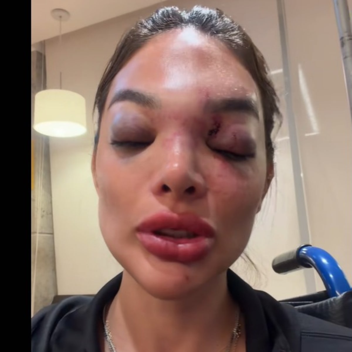 Justiça nega prisão de empresário da Faria Lima acusado de agredir a mulher; MP recorre pela 2ª vez