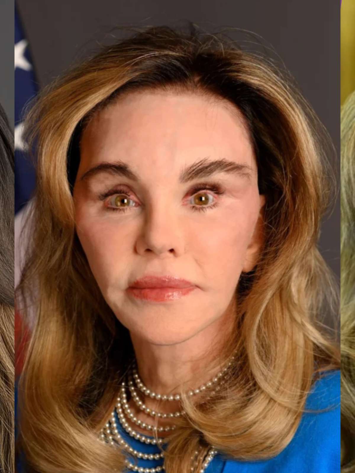 Mulheres poderosas ao redor de Trump são vítimas de ‘body shaming’ nas redes sociais