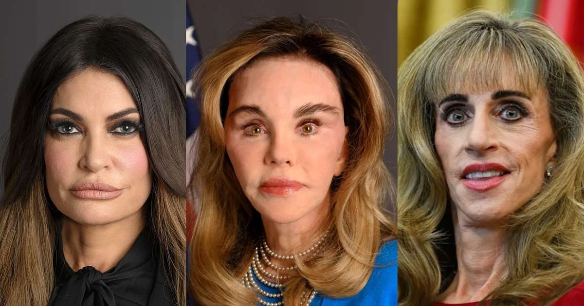 Mulheres poderosas ao redor de Trump são vítimas de ‘body shaming’ nas redes sociais