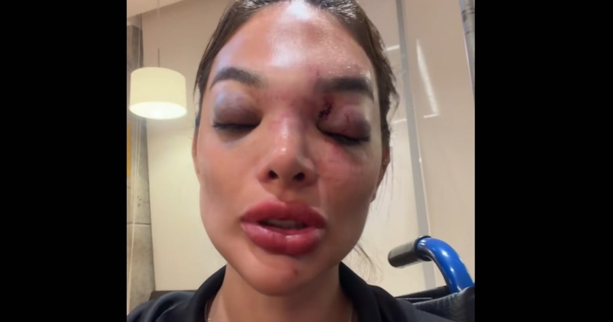 Justiça nega prisão de empresário da Faria Lima acusado de agredir a mulher; MP recorre pela 2ª vez
